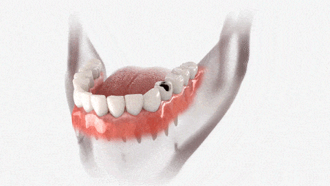 Odontología Estética en Dallas TX | Smile Makeover | Dr. Rick Miller