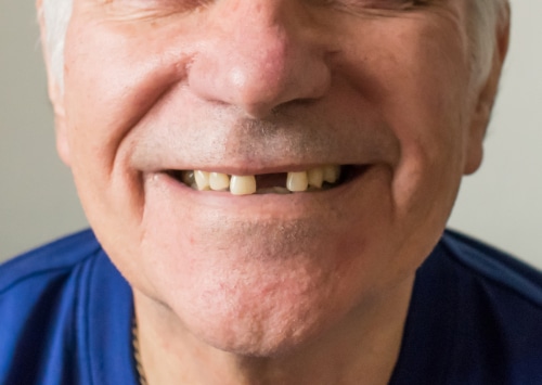 Dr. Rick Miller es su dentista de emergencia sin estrés en Dallas