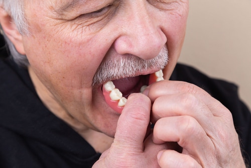 Solve Your Denture Problems with Snap-on Dentures