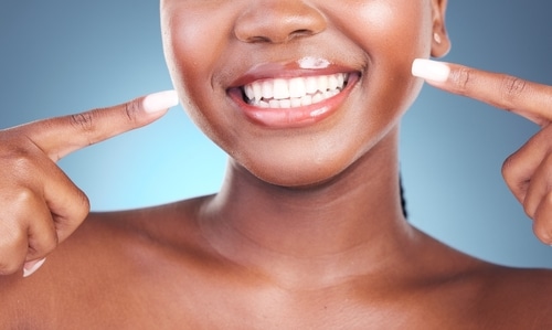 Teeth Bleaching in Dallas, TX | Free Consultations | Dr. Rick Miller