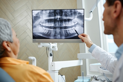 ¡Mejor Dentista de Implantes en Dallas, TX | Reserve su consulta gratis!