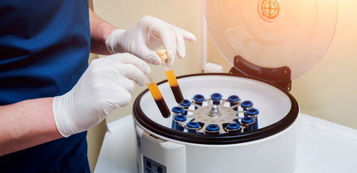 L-PRF Therapy in Dallas, TX | Support Healing After Implants