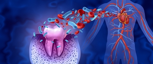 Oral Health and Heart Disease in Dallas, TX | Free Consultation 🦷